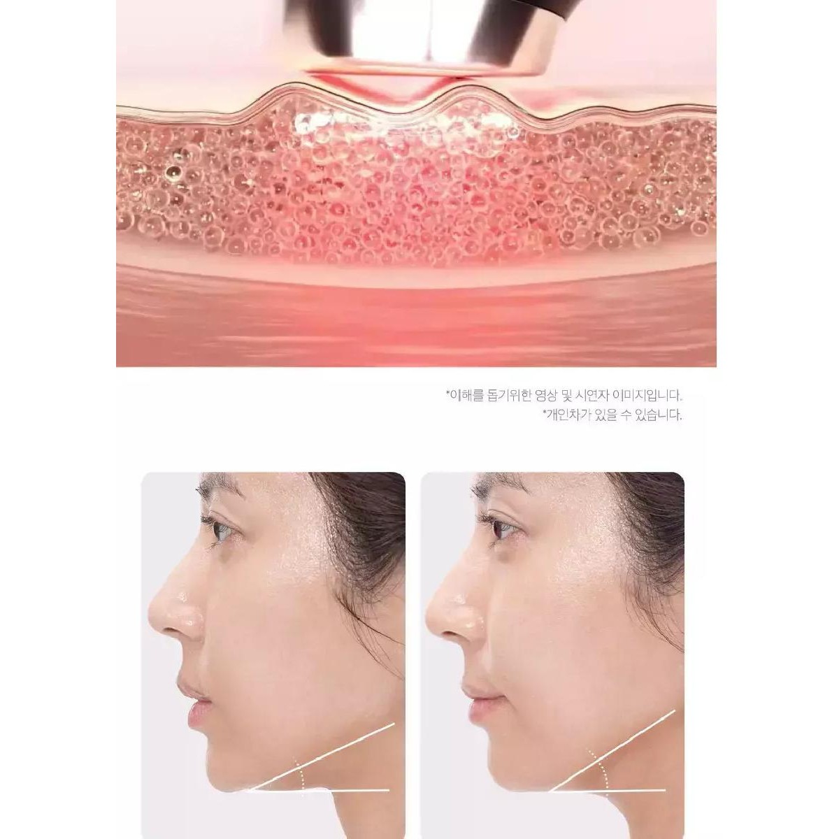 Medicube AGE-R Booster Pro Συσκευή Φωτοθεραπείας Προσώπου 6-σε-1 Pink Medicube AGE-R Booster Pro Συσκευή Φωτοθεραπείας Προσώπου 6-σε-1 Pink