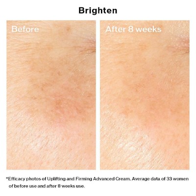 Shiseido Vital Perfection Uplifting And Firming Advanced Cream 50ml Αντιγηραντική Κρέμα Προσώπου